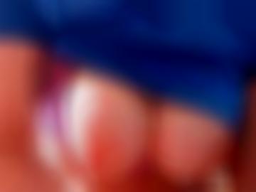 natürlich schnellsuche - anzeigen ort, registriere binsfeld