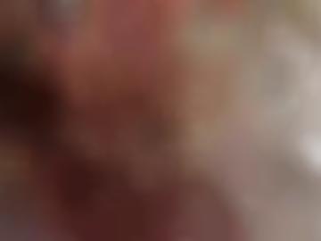 erkläre blasen - dazu seit, community schnellsuche